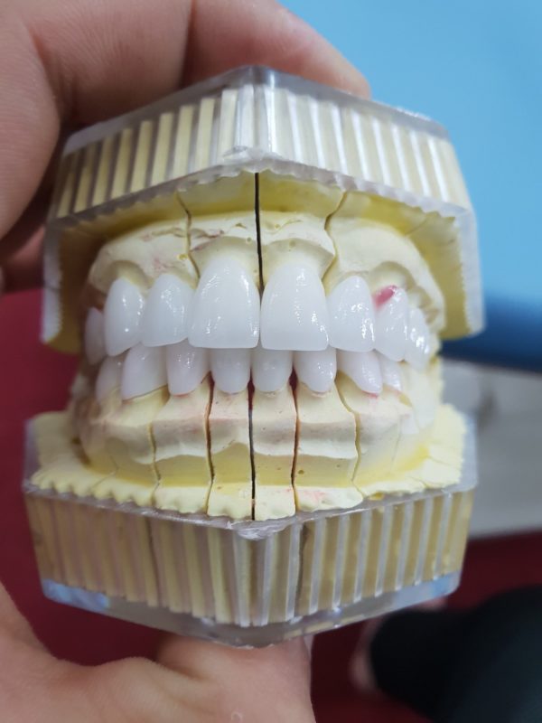 Trung Tâm Bảo Hành Răng Sứ