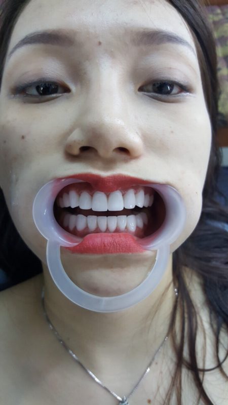 Trung Tâm Bảo Hành Răng Sứ
