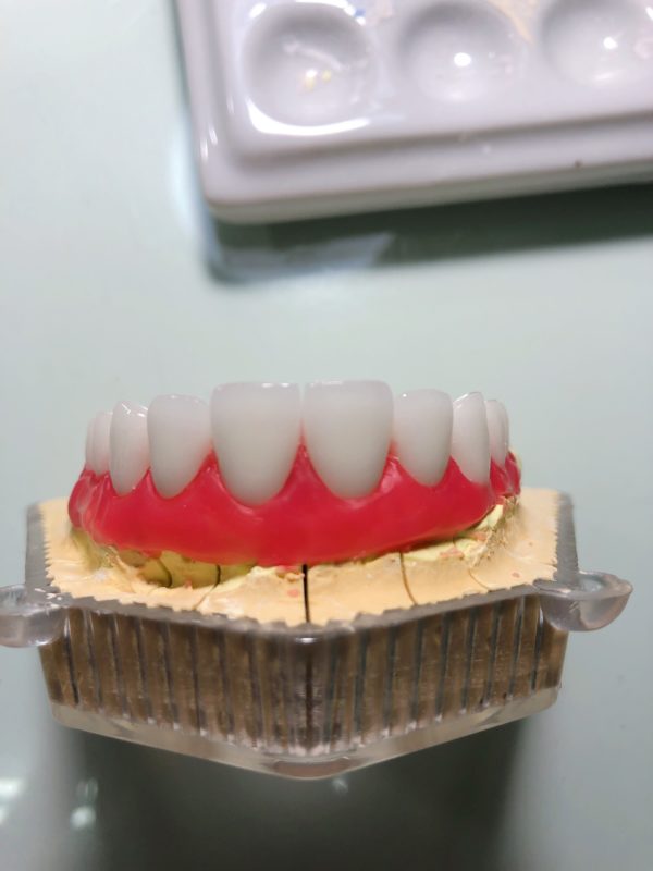 Trung Tâm Bảo Hành Răng Sứ