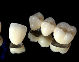 ZIRCONIA