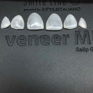 Mặt dán sứ venner